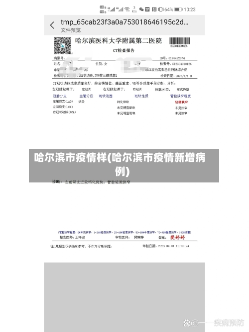 哈尔滨市疫情样(哈尔滨市疫情新增病例)